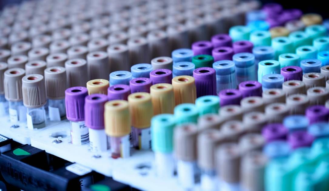 Labcorp Settles Data Breach Lawsuit with $2.3 Million Fine and Mandatory Vendor Security Reforms